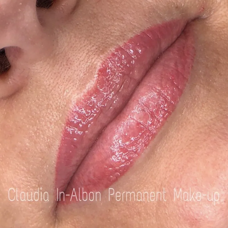 Lippenpigmentierung