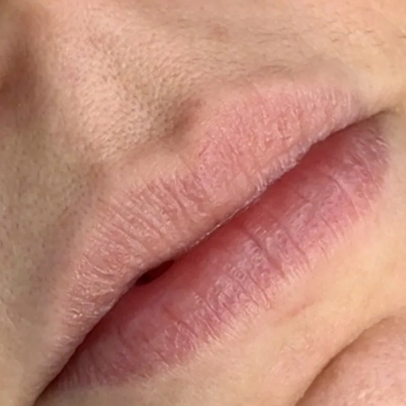 Lippenpigmentierung